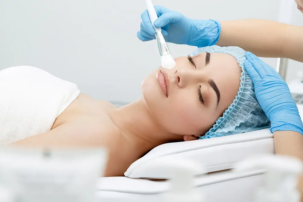 Skin Peel Facial