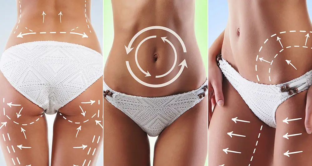 Cavitation