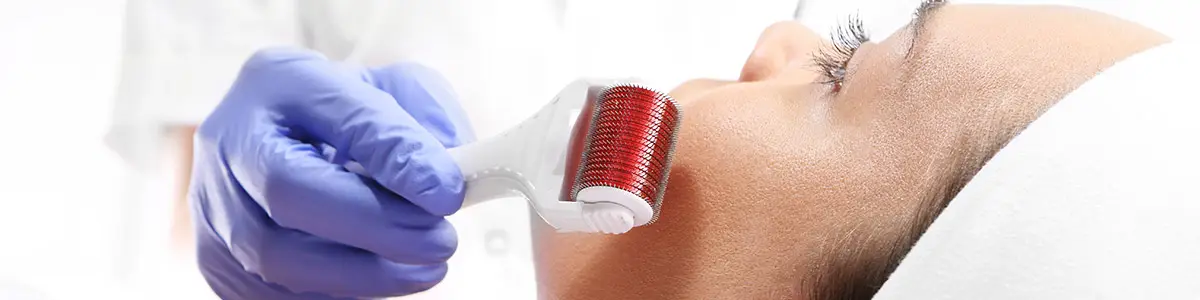 Cryolipolysis