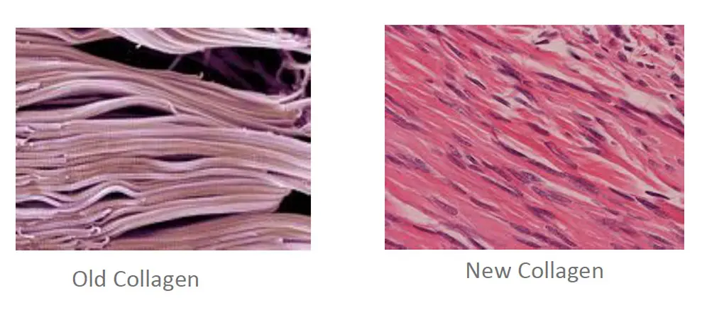 Collagen Diagram