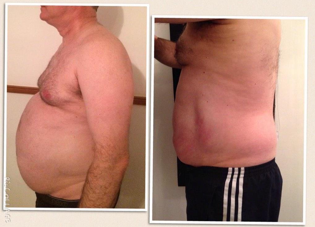 8 sessions of Cavitation